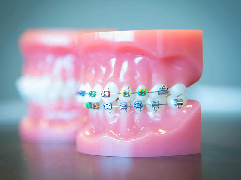 Best Dental Clinic in Mau