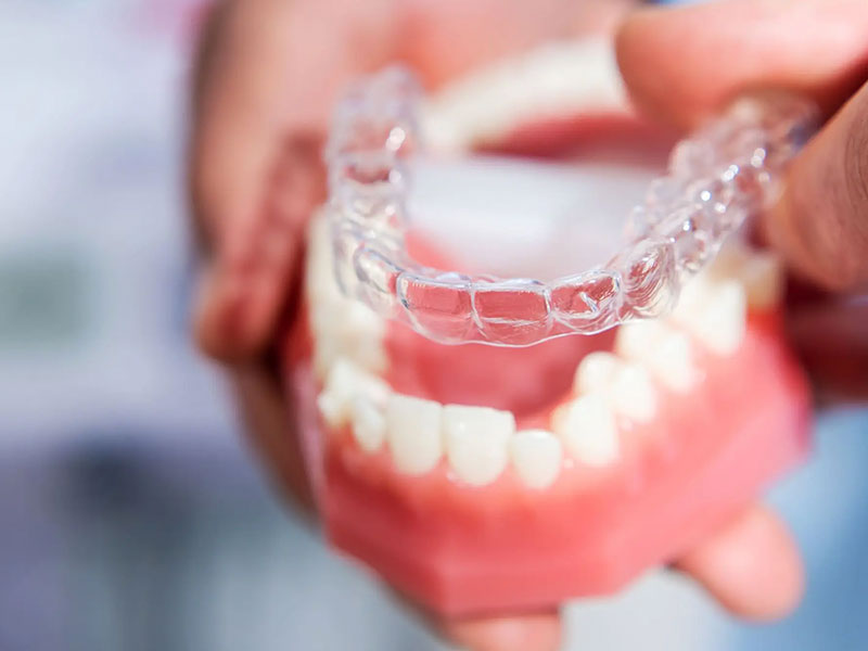 Best Dental Clinic in Mau