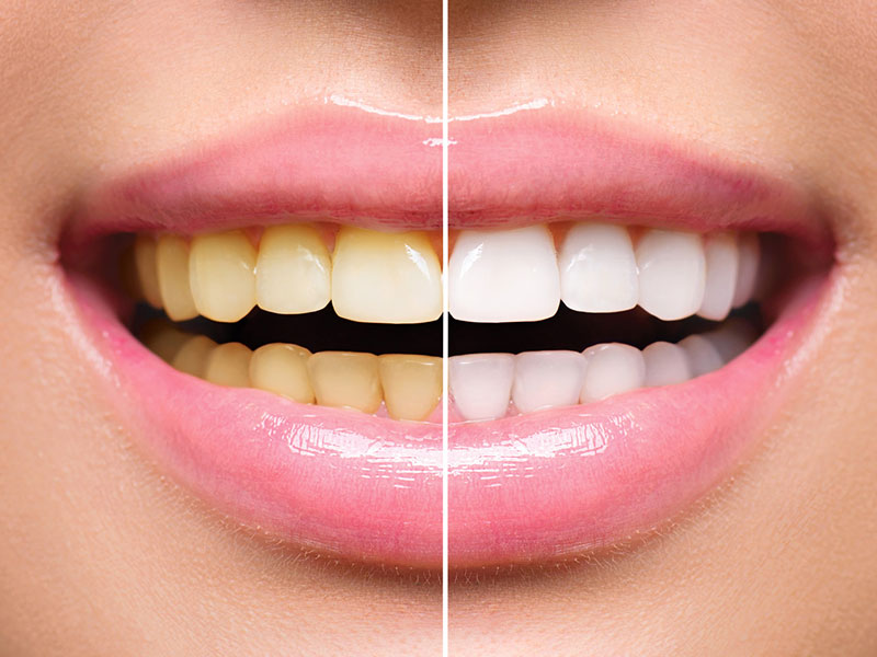 Best Dental Clinic in Mau
