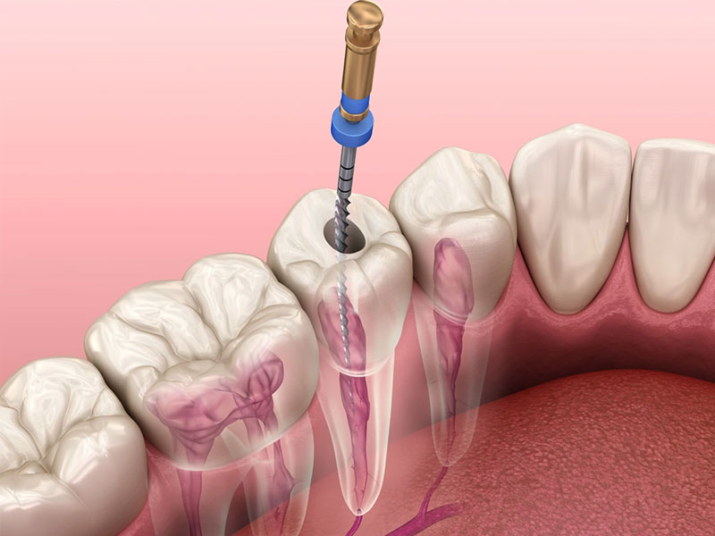 Best Dental Clinic in Mau